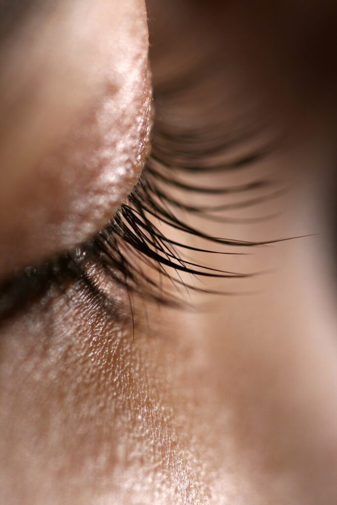 Eye Treatments