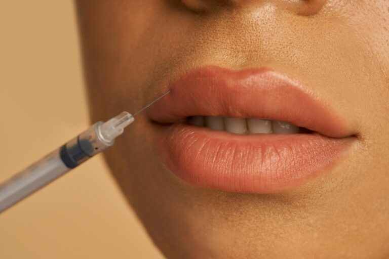 lip fillers Sunderland
